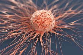 Understanding Solid Tumors: A Comprehensive Overview