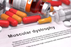 Unveiling Duchenne Muscular Dystrophy: From Diagnosis to Emerging Therapies